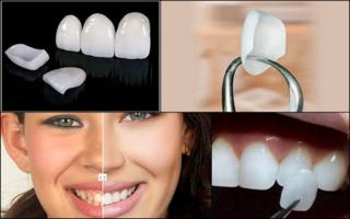 Ortodontia no Santa Efignia BH  - Implantes Dentrios e Prtese no Santa Efignia BH