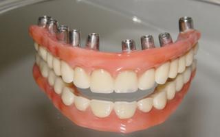 Clarus - Clareamento Dental no Santa Efignia BH