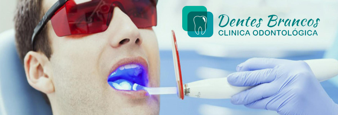 Clareamento dental na Clinica odontologica Dentes Brancos em laranjeiras Serra ES